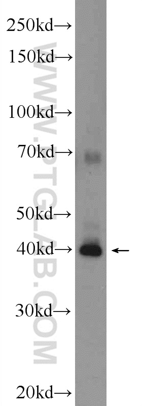 WB analysis of HeLa using 22123-1-AP