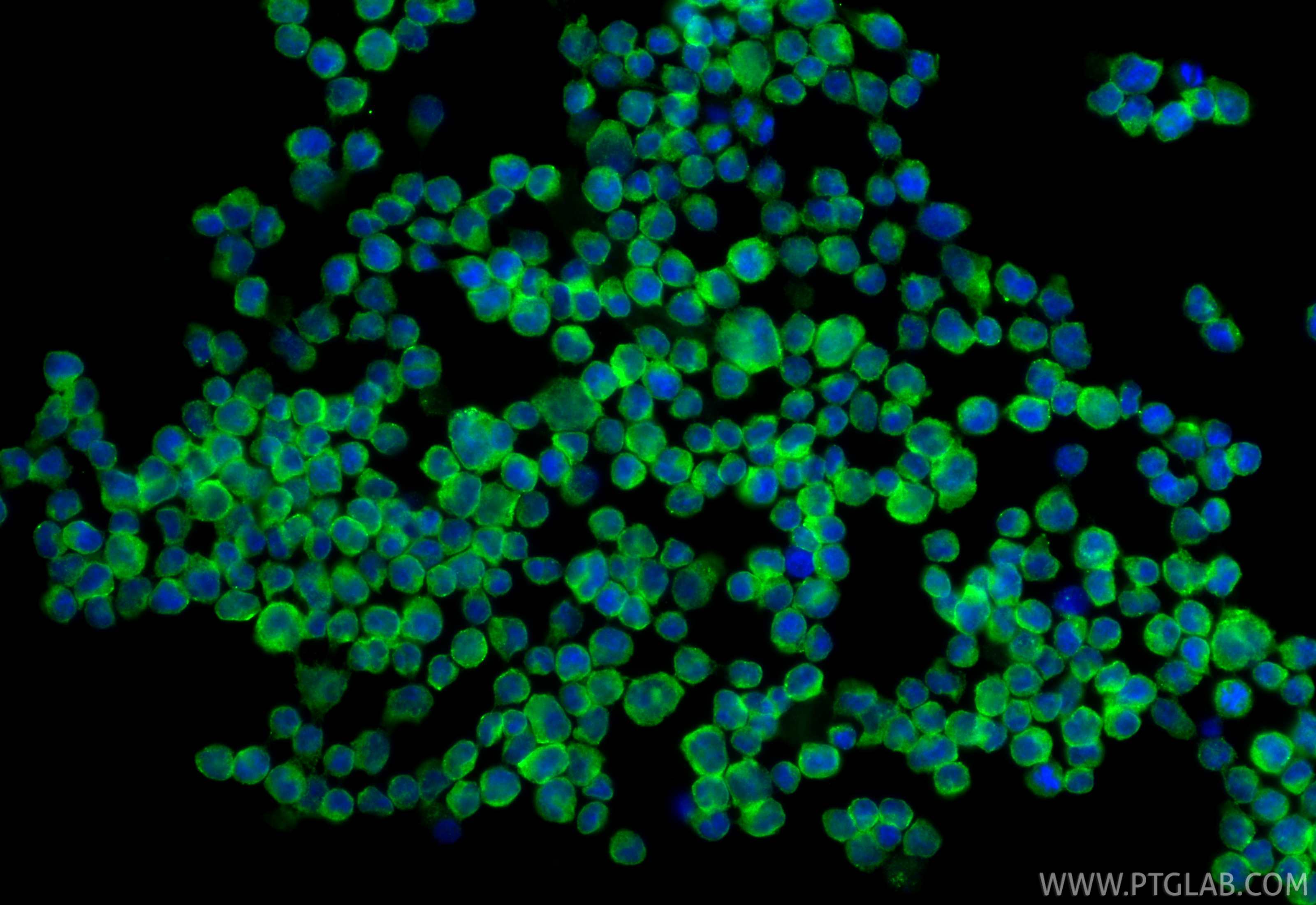 IF Staining of Daudi using 22711-1-AP IF Staining of Daudi using 22711-1-AP