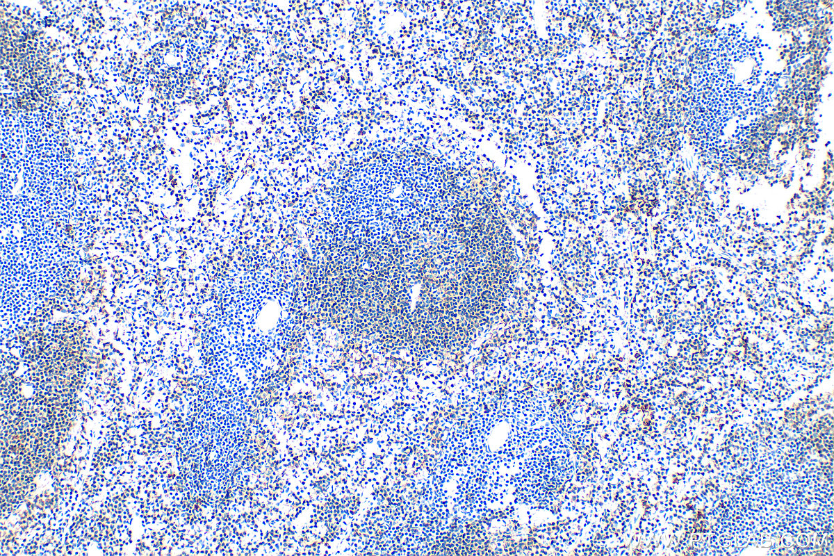 IHC staining of mouse spleen using 33396-1-AP