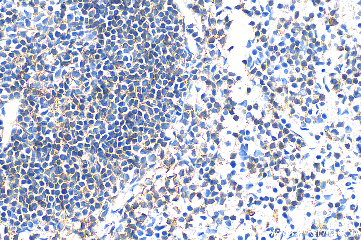 IHC staining of mouse spleen using 33396-1-AP