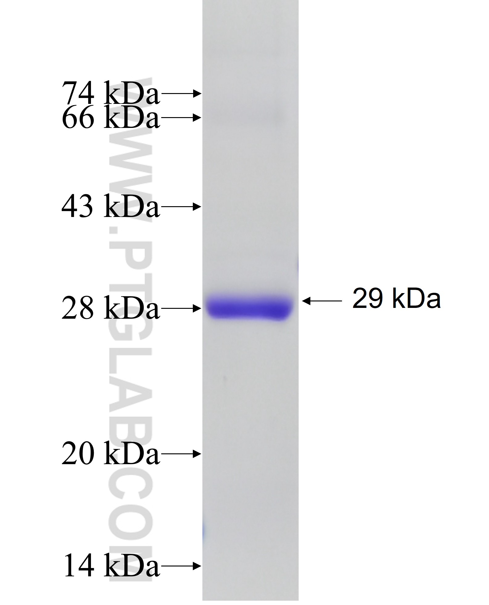 SLAMF6 fusion protein Ag32532 SDS-PAGE SLAMF6 fusion protein Ag32532 SDS-PAGE