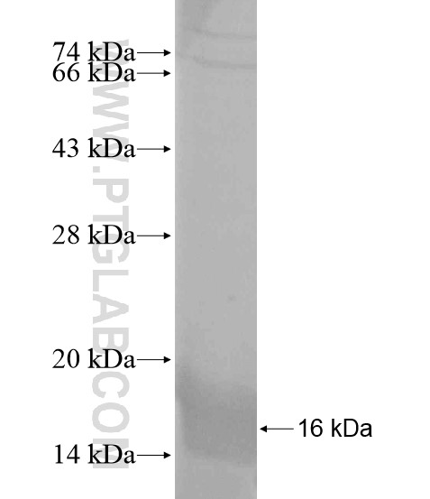 SLC10A2 fusion protein Ag18873 SDS-PAGE SLC10A2 fusion protein Ag18873 SDS-PAGE