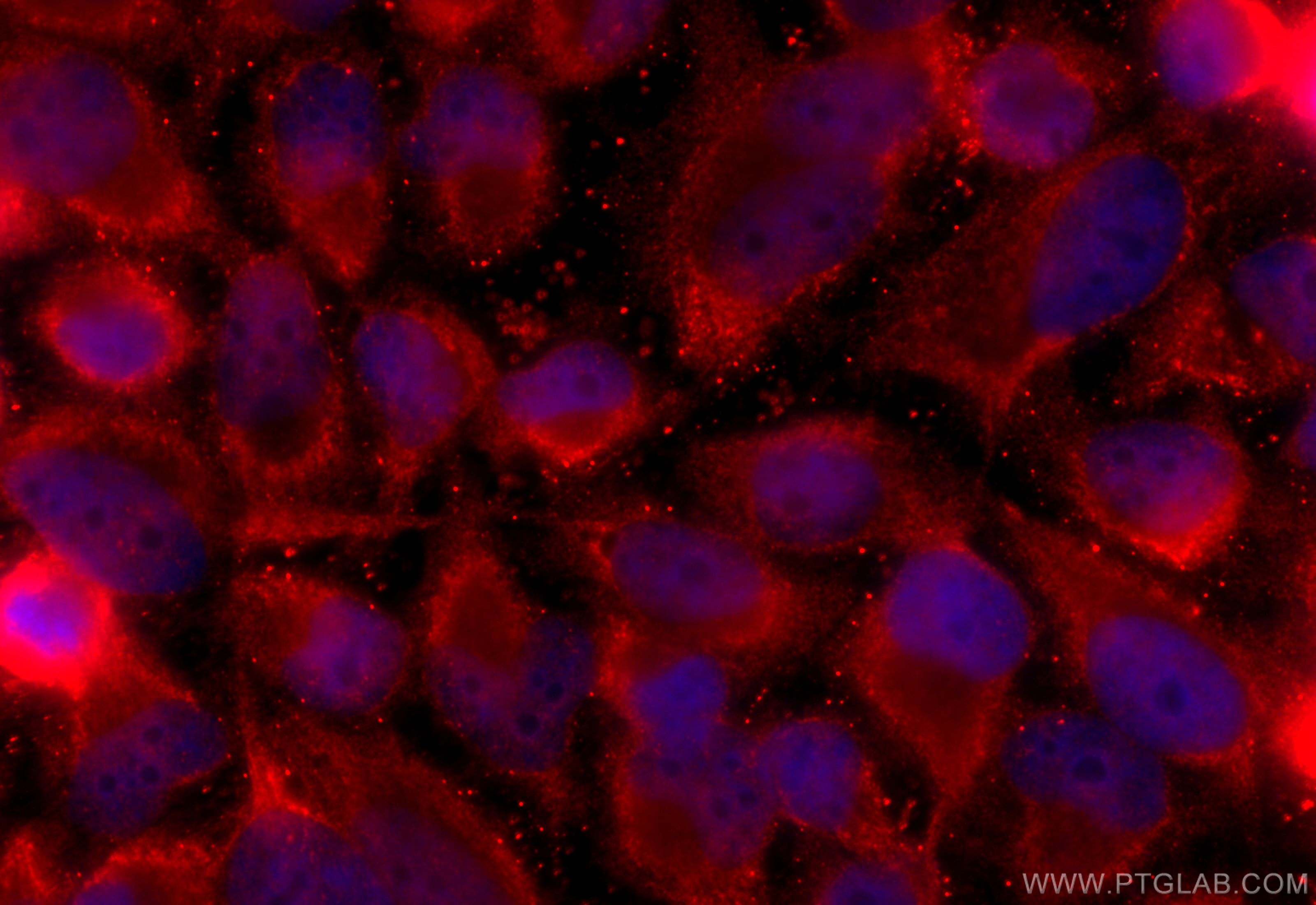IF Staining of HeLa using 19909-1-AP