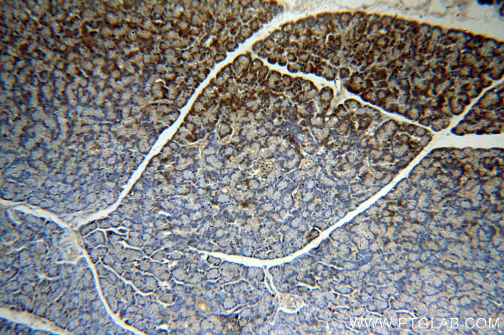 IHC staining of human pancreas using 19909-1-AP