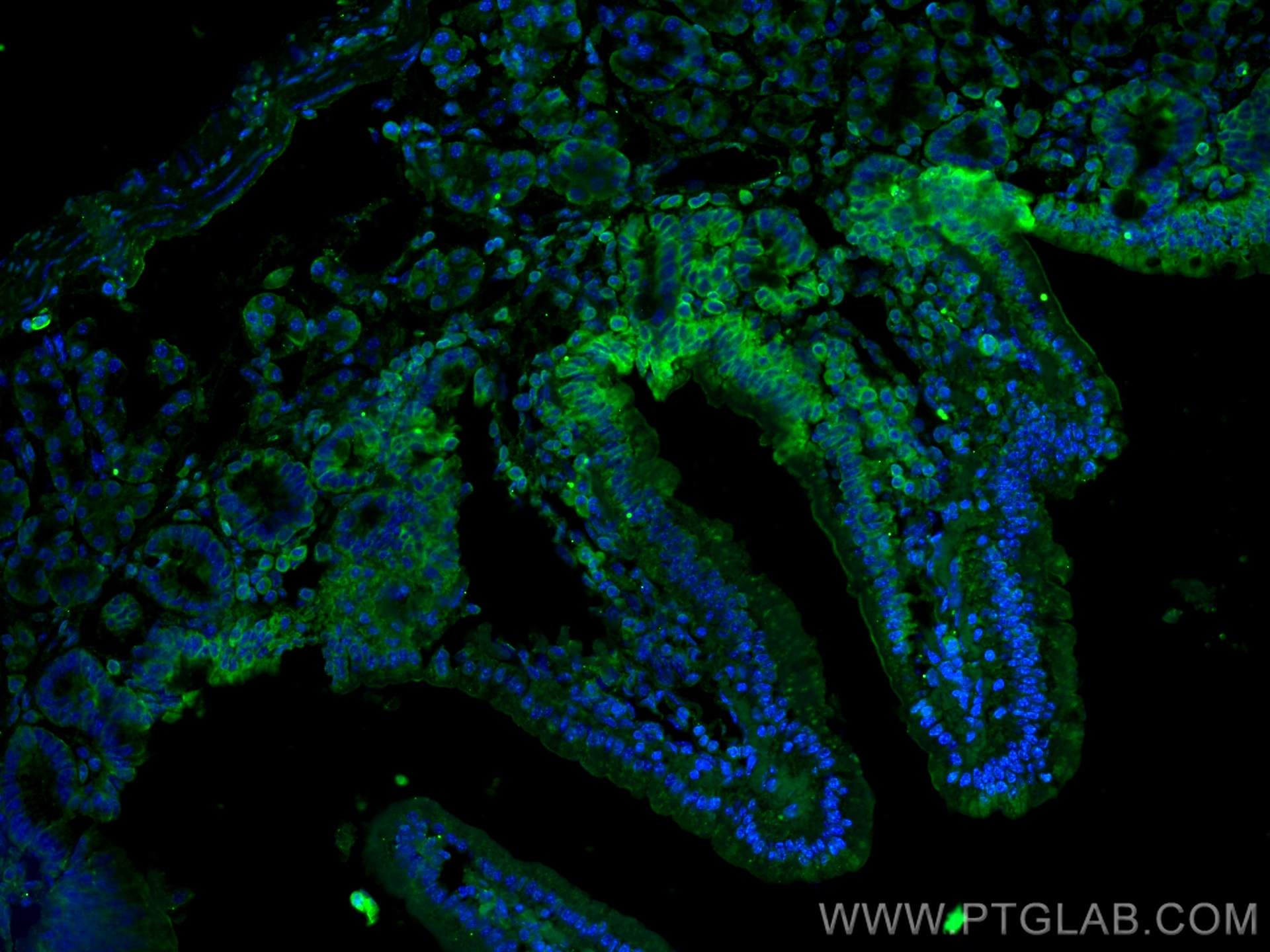 IF Staining of mouse small intestine using 20507-1-AP