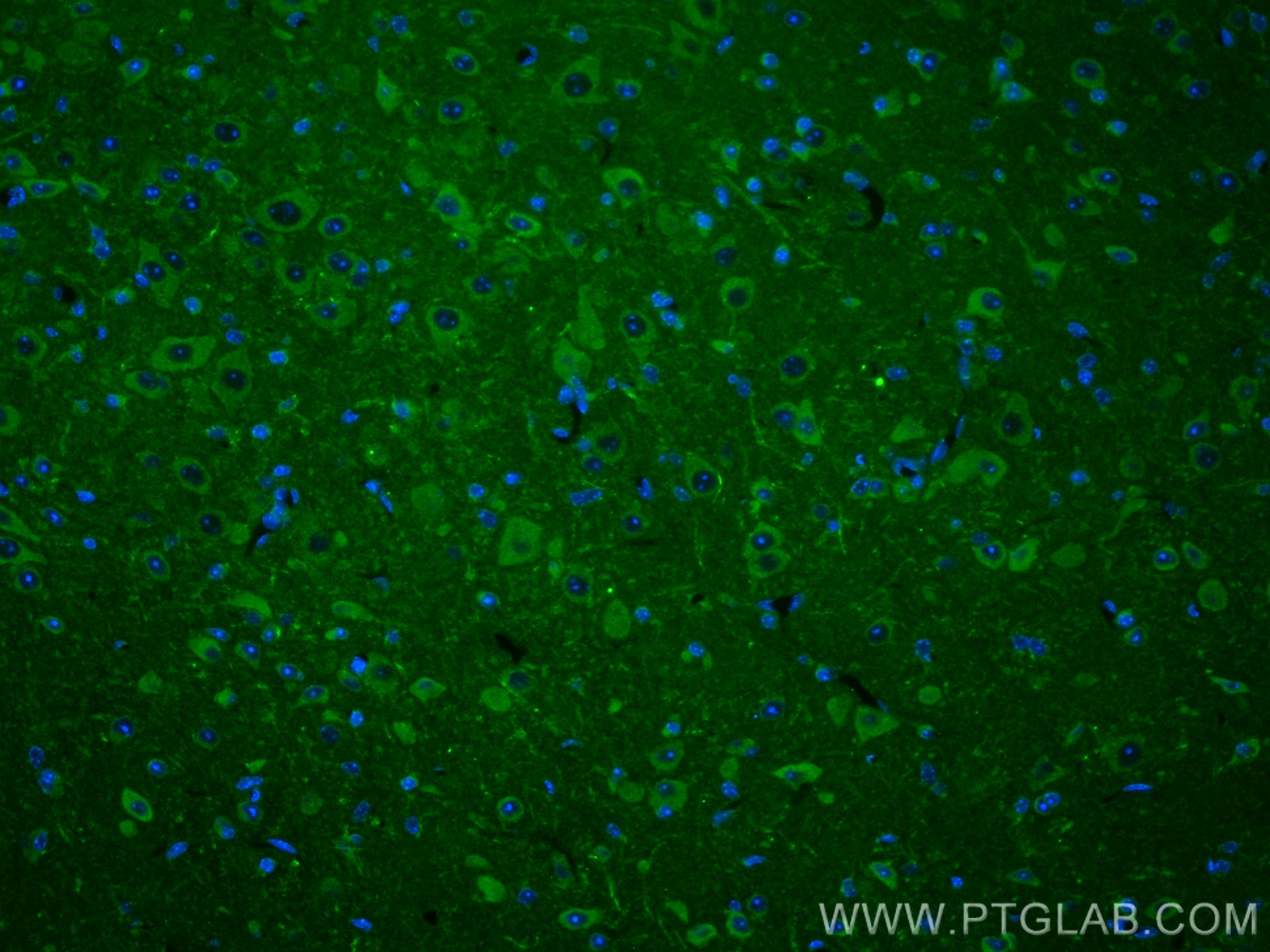 IF Staining of mouse brain using 20507-1-AP