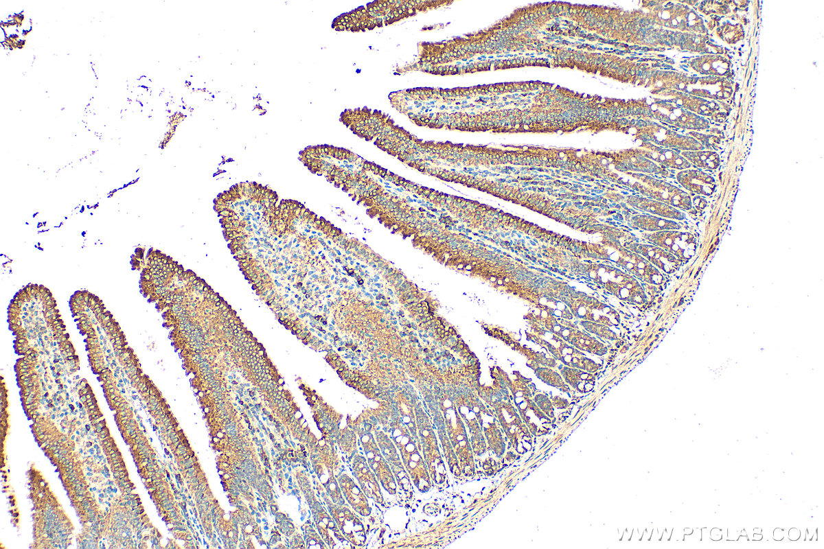 Immunohistochemical analysis of paraffin-embedded mouse small intestine tissue slide using 20507-1-AP (DMT1 antibody) at dilution of 1:400 (under 10x lens). Heat mediated antigen retrieval with Tris-EDTA buffer (pH 9.0). IHC staining of mouse small intestine using 20507-1-AP
