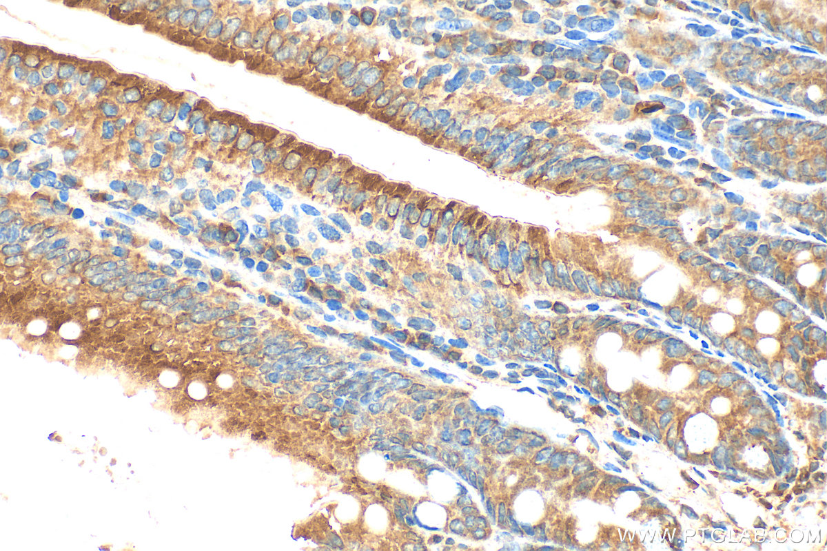 Immunohistochemical analysis of paraffin-embedded mouse small intestine tissue slide using 20507-1-AP (DMT1 antibody) at dilution of 1:400 (under 40x lens). Heat mediated antigen retrieval with Tris-EDTA buffer (pH 9.0). IHC staining of mouse small intestine using 20507-1-AP