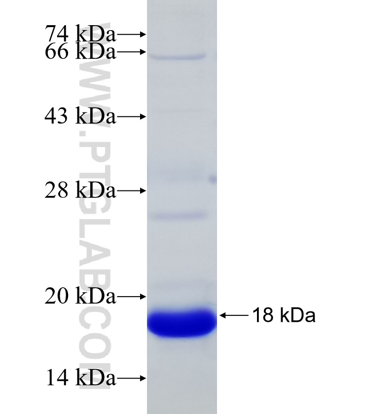SLC11A2 fusion protein Ag16824 SDS-PAGE