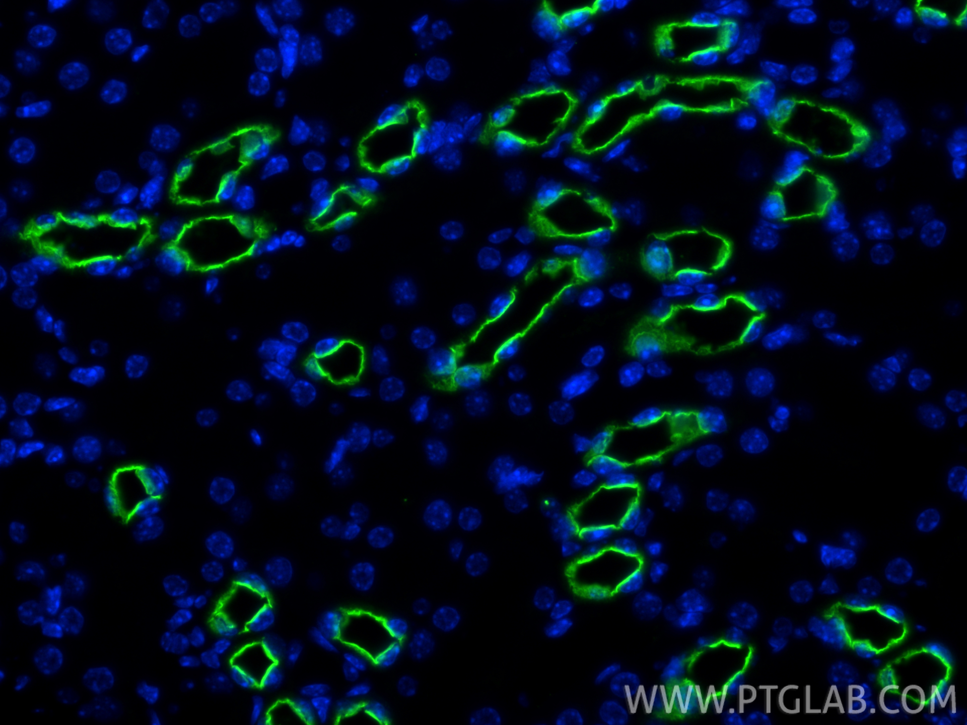 IF Staining of mouse kidney using 18970-1-AP