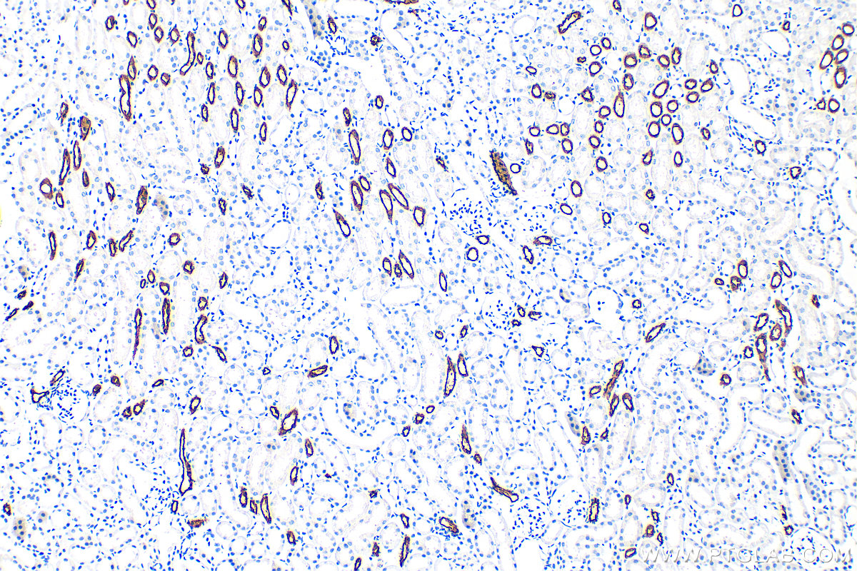 IHC staining of mouse kidney using 18970-1-AP