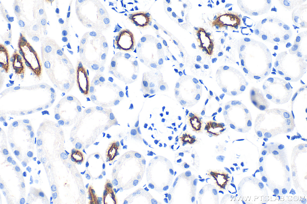 IHC staining of mouse kidney using 18970-1-AP