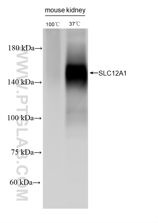 WB analysis using 87210-1-RR WB analysis using 87210-1-RR