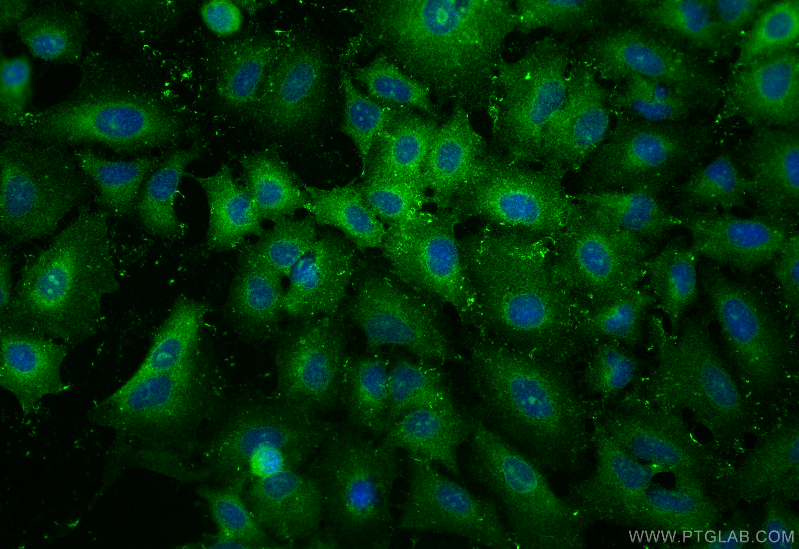 IF Staining of A549 using 13884-1-AP