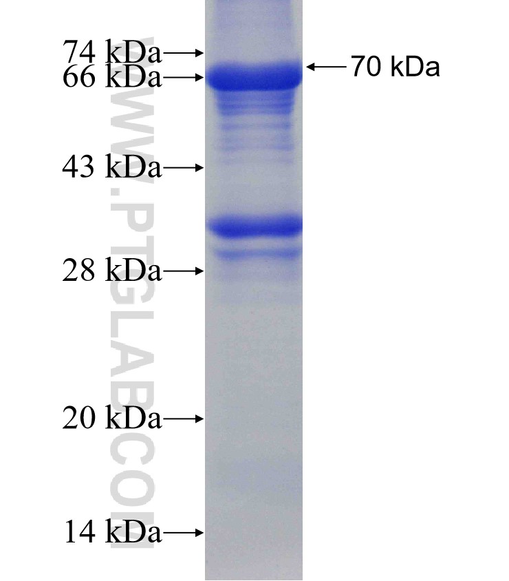 SLC12A2 fusion protein Ag4991 SDS-PAGE