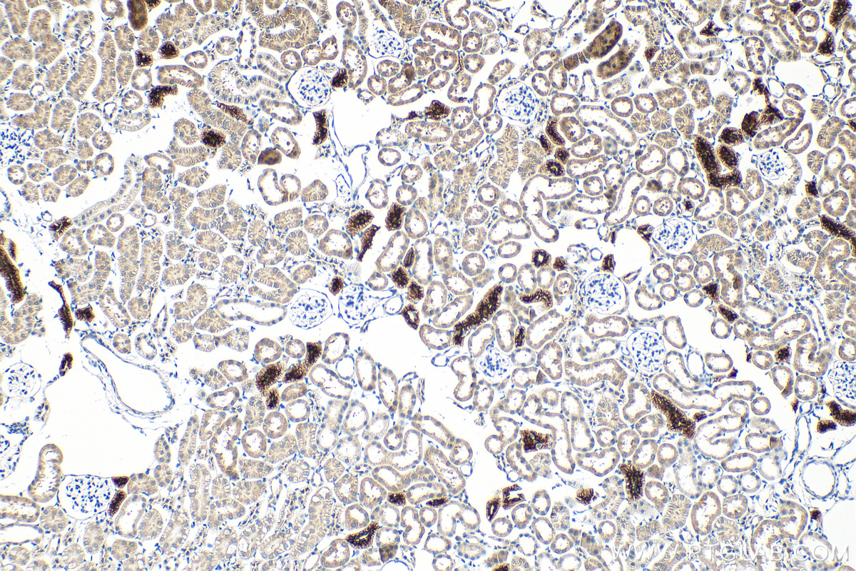 IHC staining of mouse kidney using 55442-1-AP