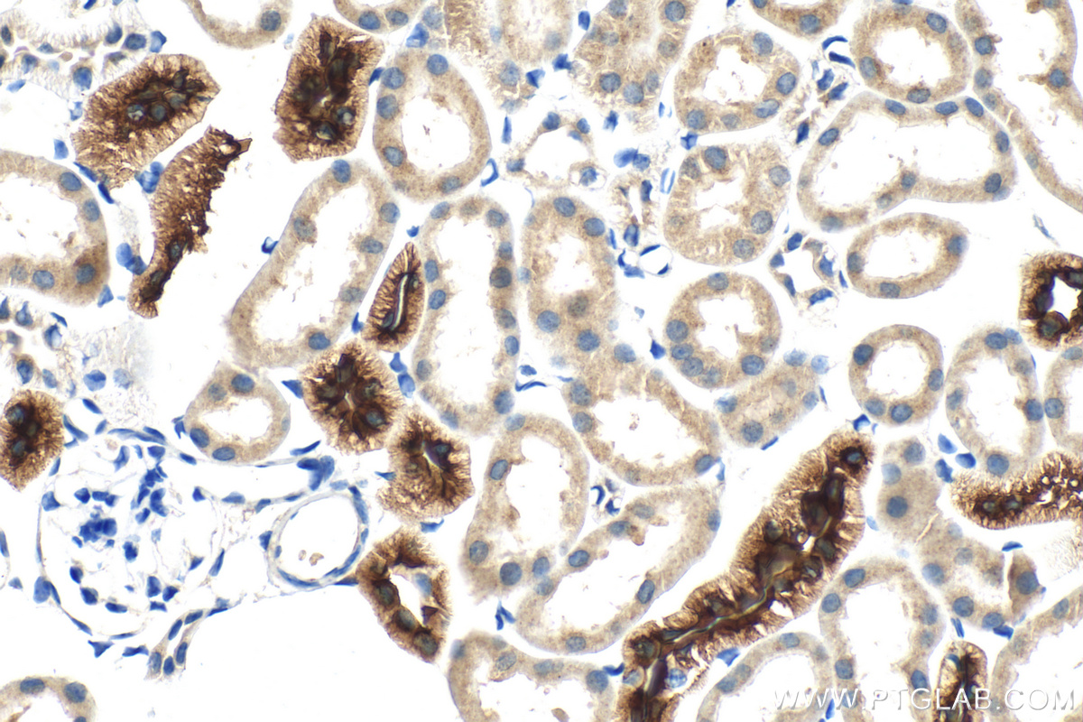 IHC staining of mouse kidney using 55442-1-AP