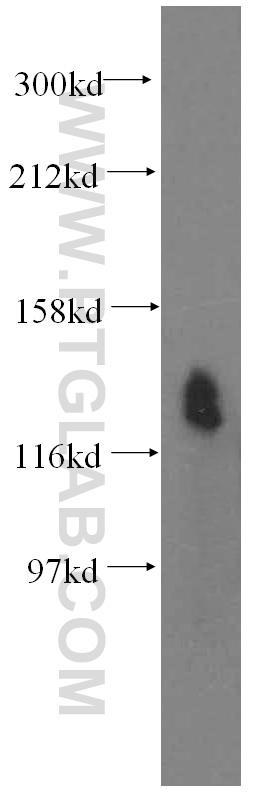 WB analysis of HeLa using 15927-1-AP