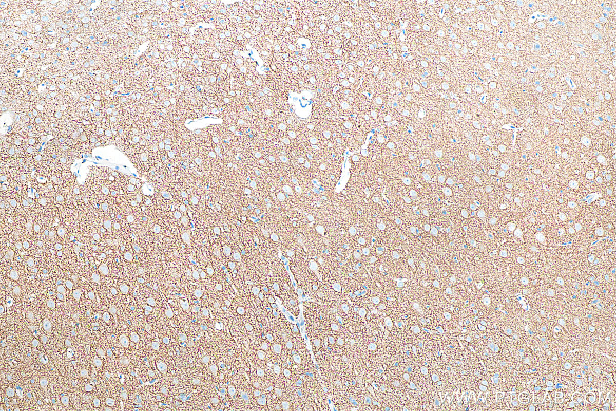 IHC staining of rat brain using 19565-1-AP