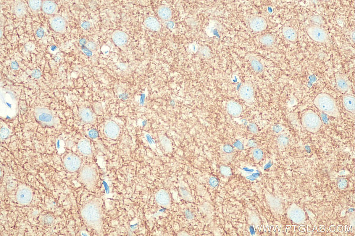 IHC staining of rat brain using 19565-1-AP