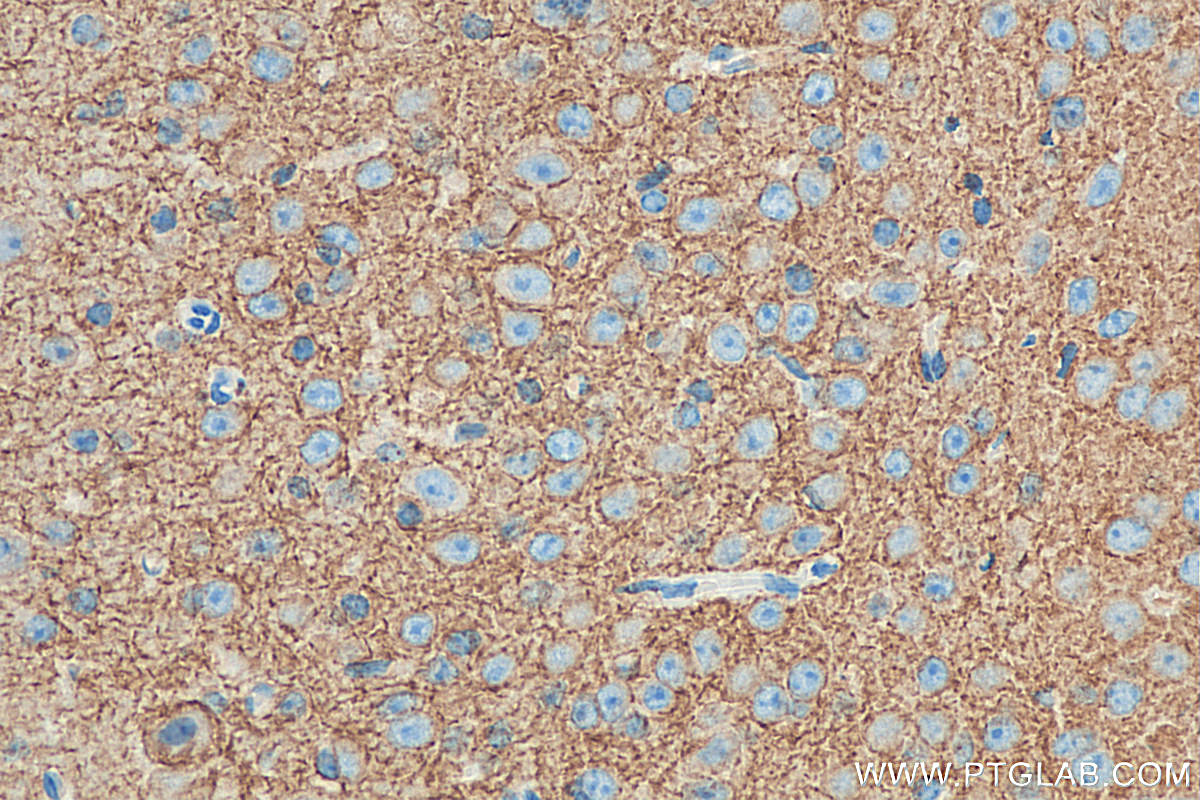 IHC staining of mouse brain using 19565-1-AP