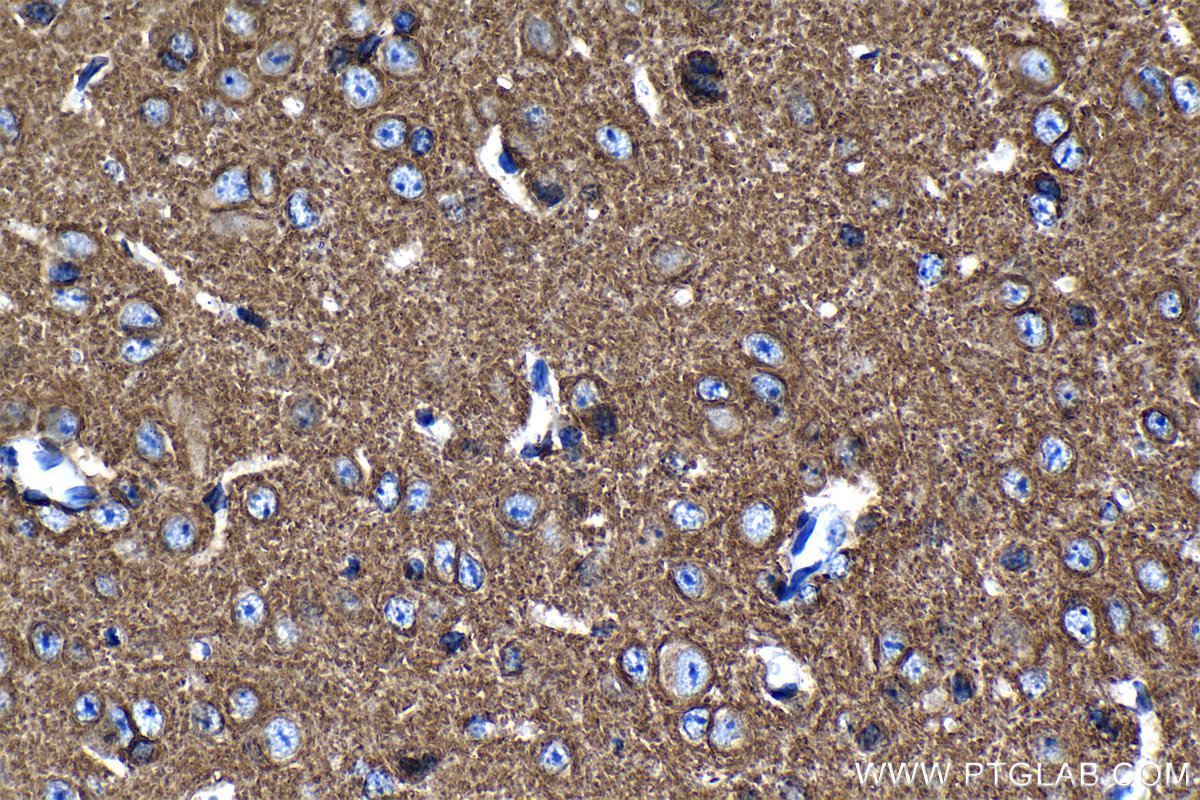 IHC staining of mouse cerebellum using 19565-1-AP IHC staining of mouse cerebellum using 19565-1-AP
