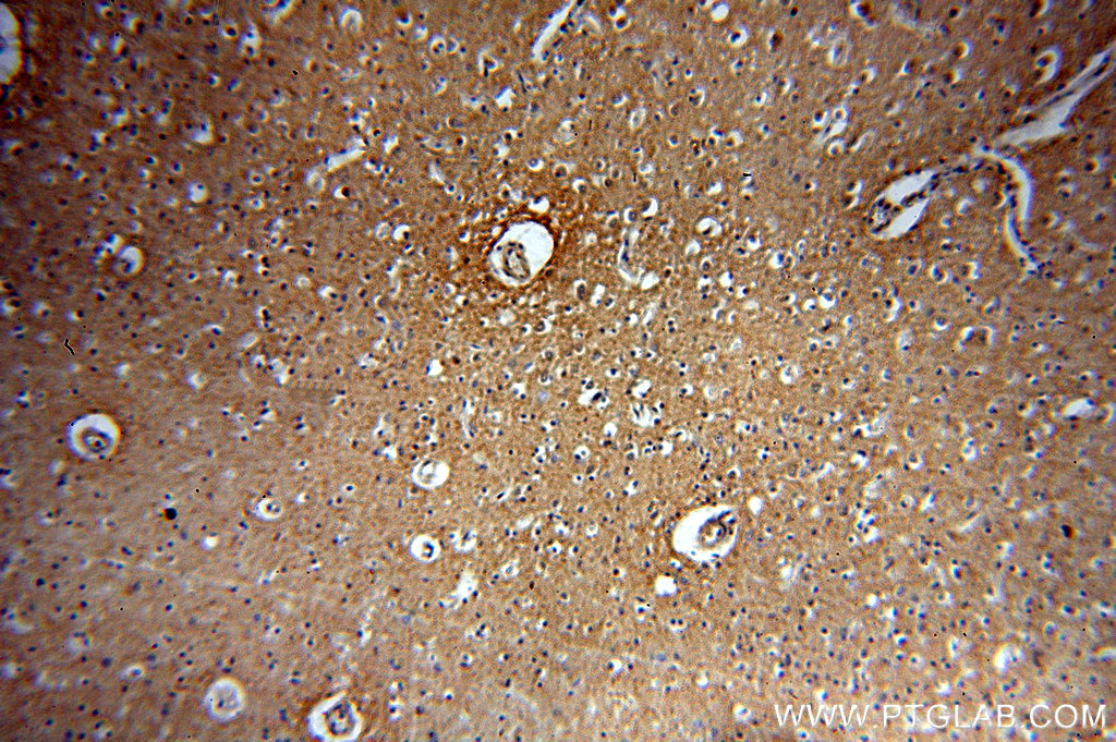 IHC staining of human brain using 19565-1-AP