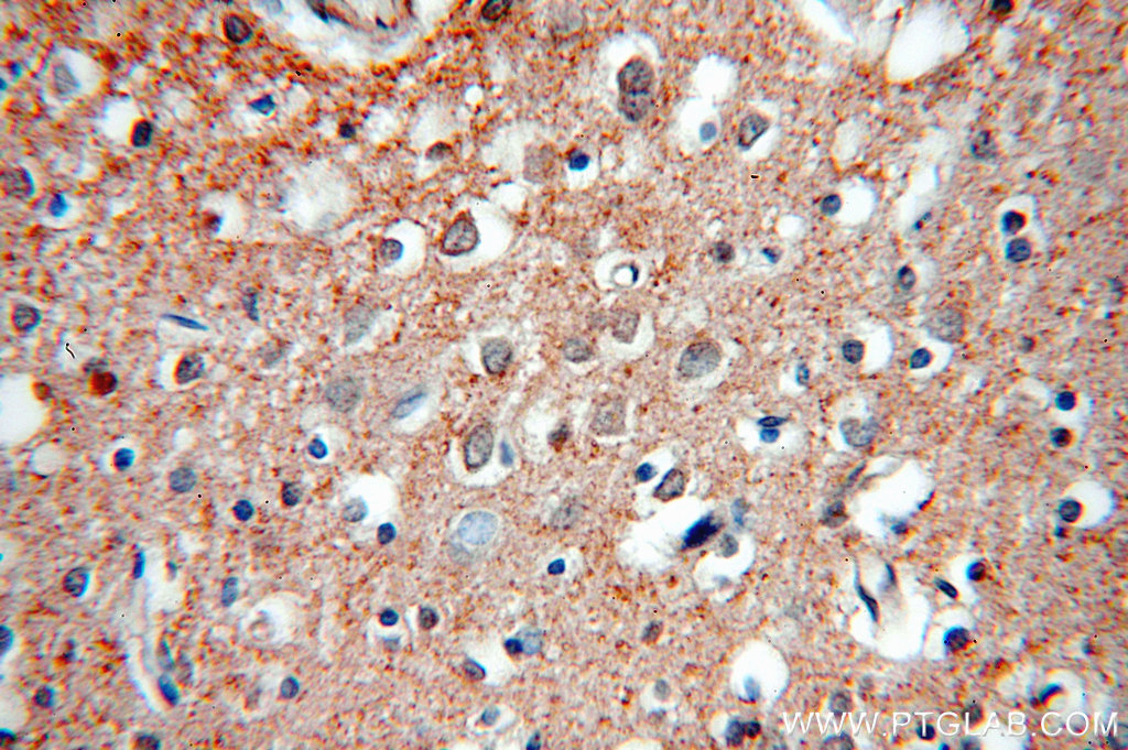 IHC staining of human brain using 19565-1-AP