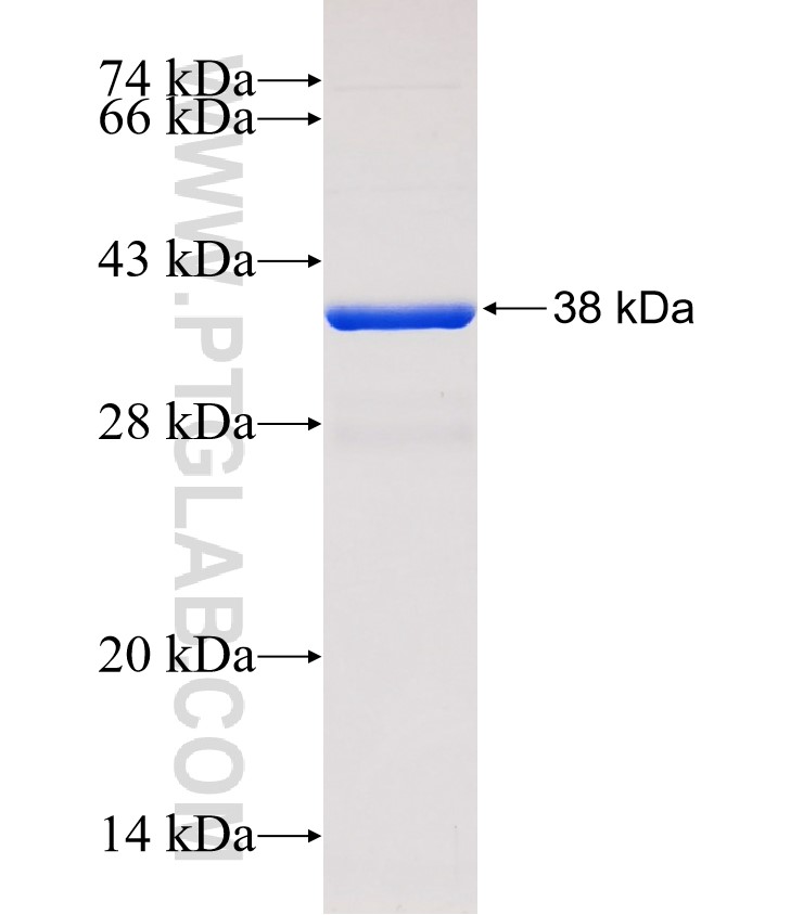 SLC12A6 fusion protein Ag31965 SDS-PAGE