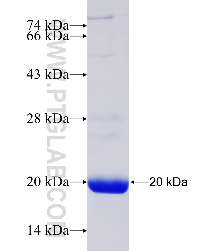 SLC12A6 fusion protein Ag31982 SDS-PAGE