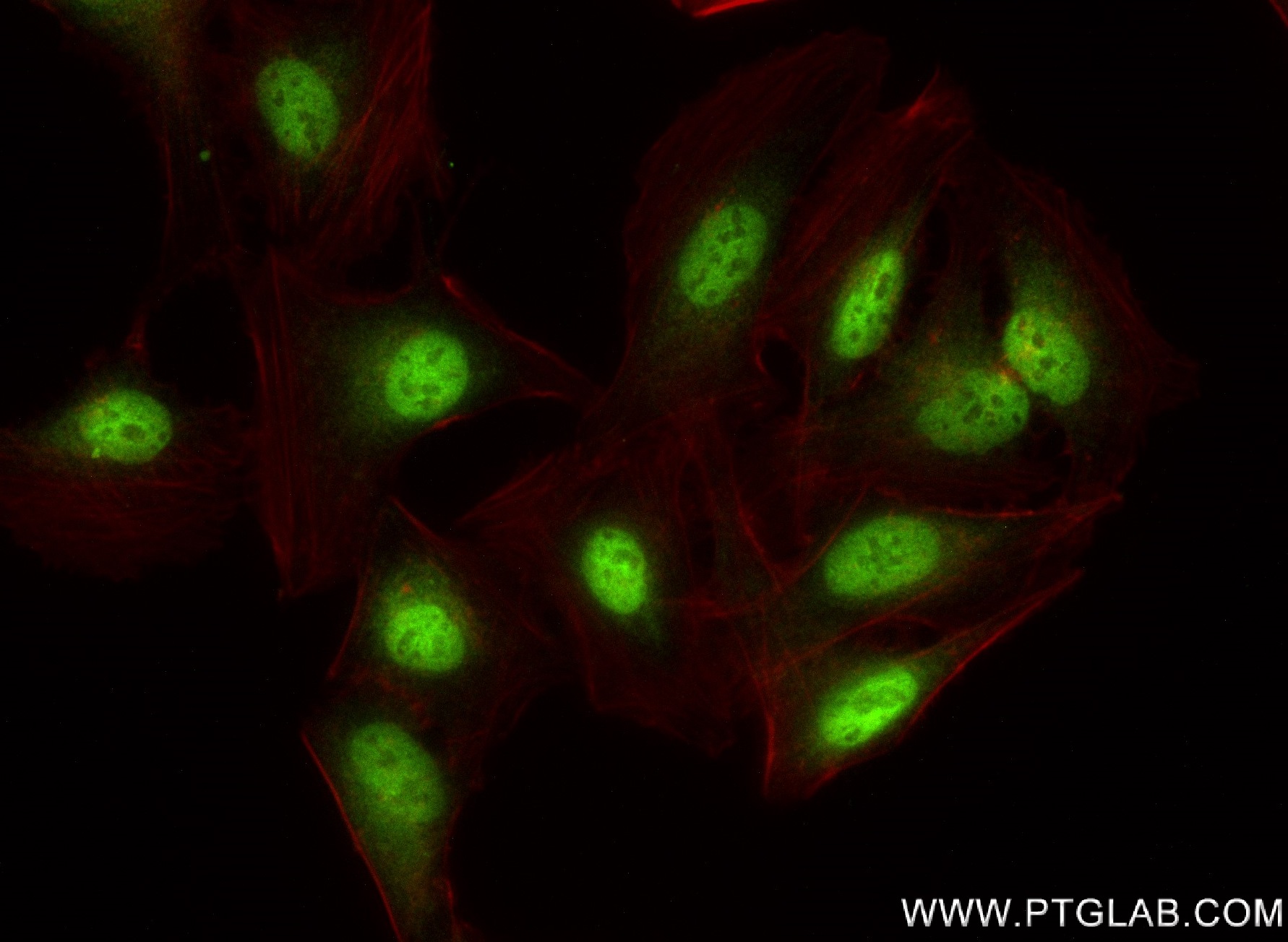 IF Staining of U2OS using 83225-2-RR (same clone as 83225-2-PBS)