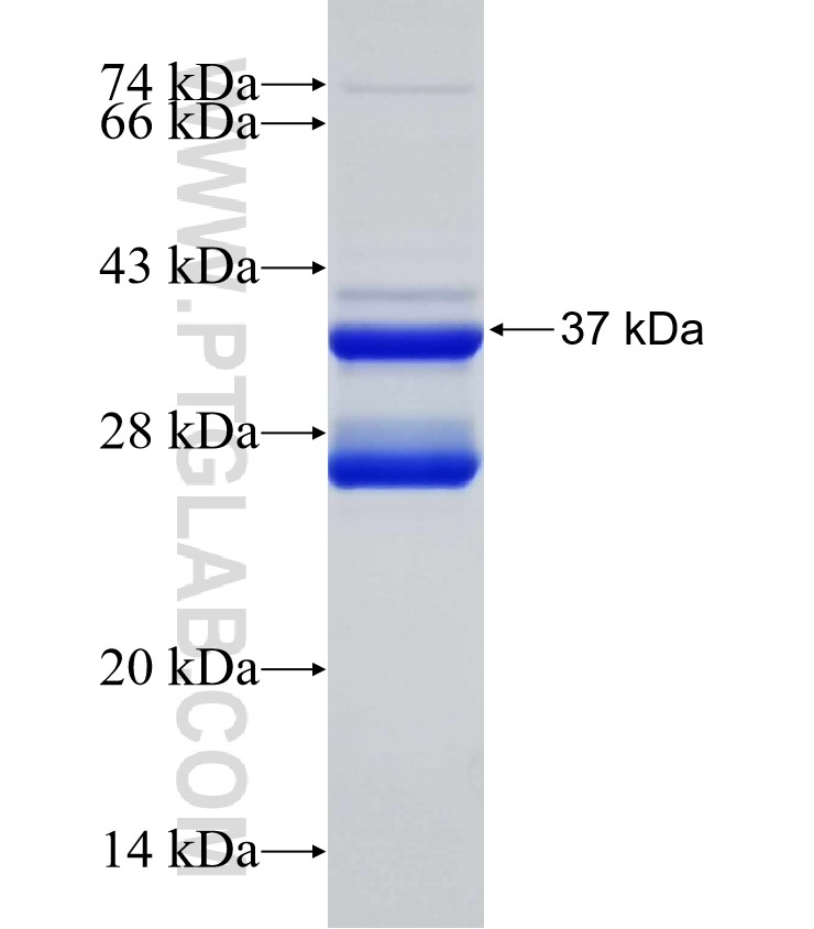 SLC12A9 fusion protein Ag25358 SDS-PAGE