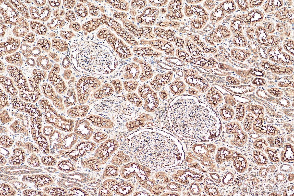 IHC staining of human kidney using 21722-1-AP