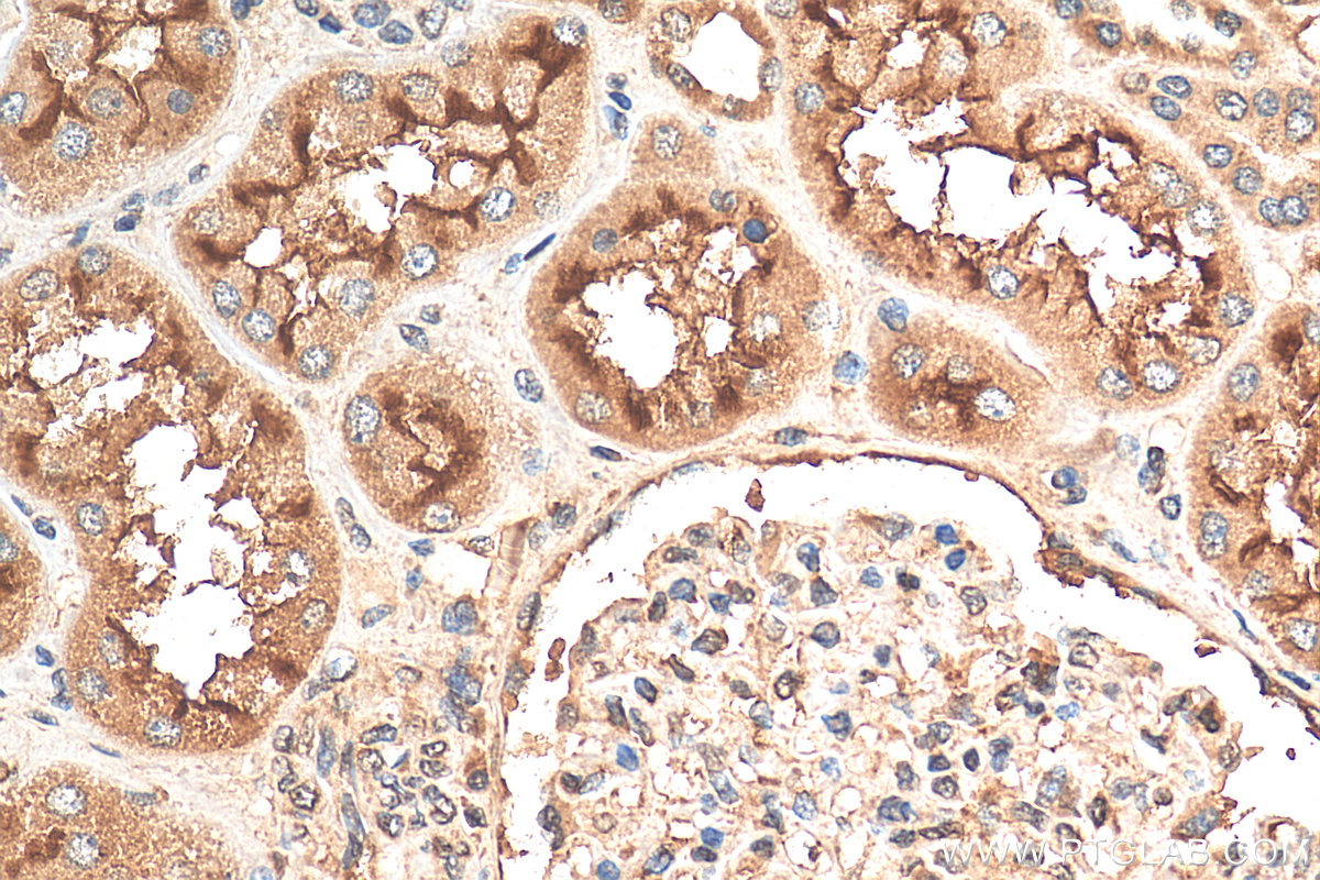 IHC staining of human kidney using 21722-1-AP