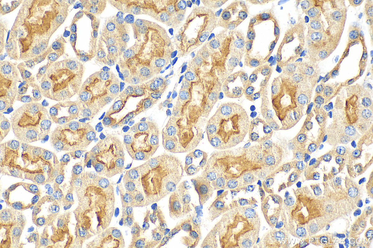 IHC staining of mouse kidney using 21722-1-AP
