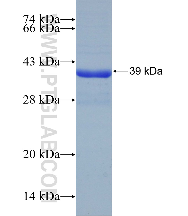 SLC13A2 fusion protein Ag16379 SDS-PAGE