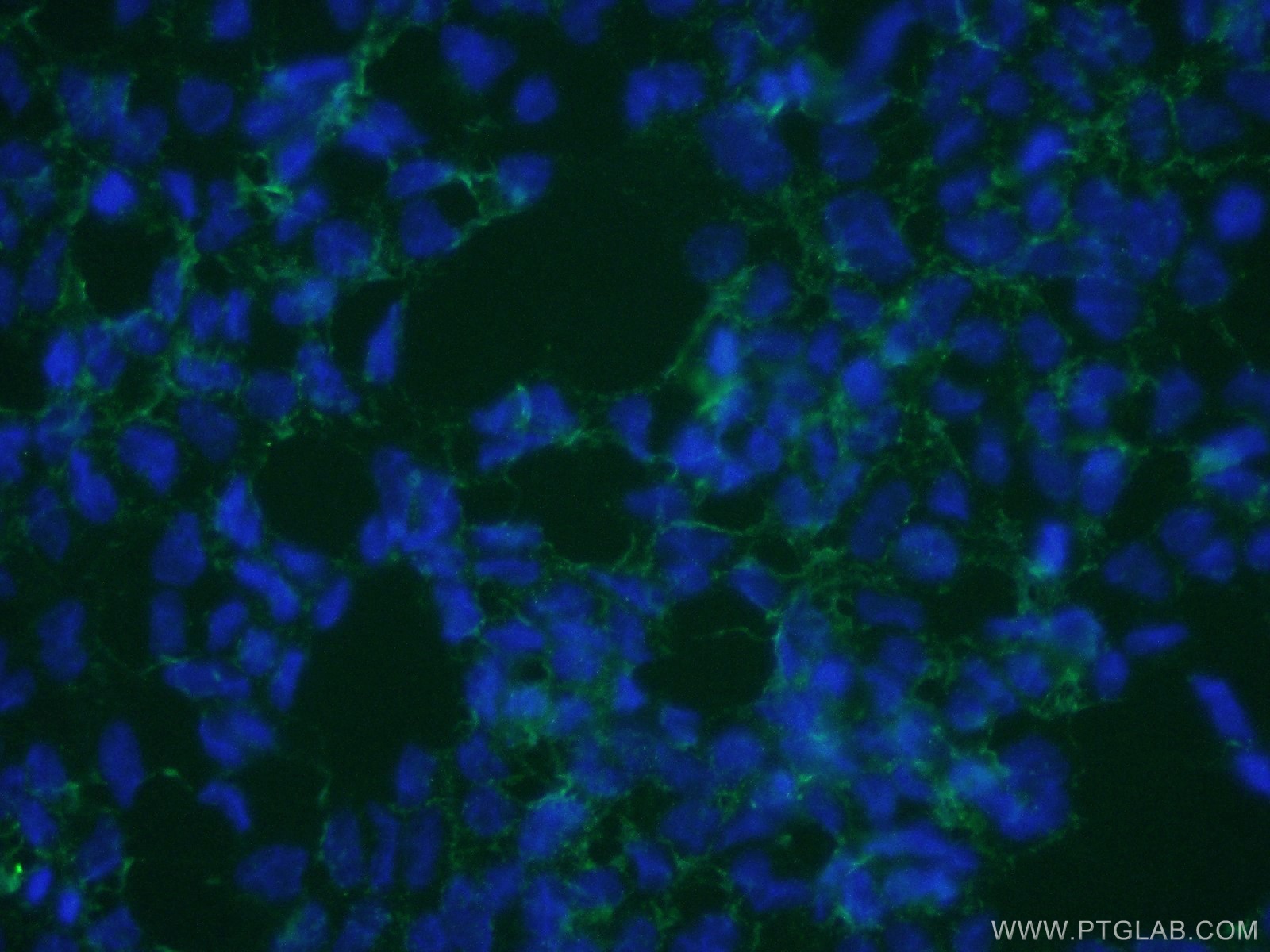 IF Staining of HEK-293 using 20302-1-AP