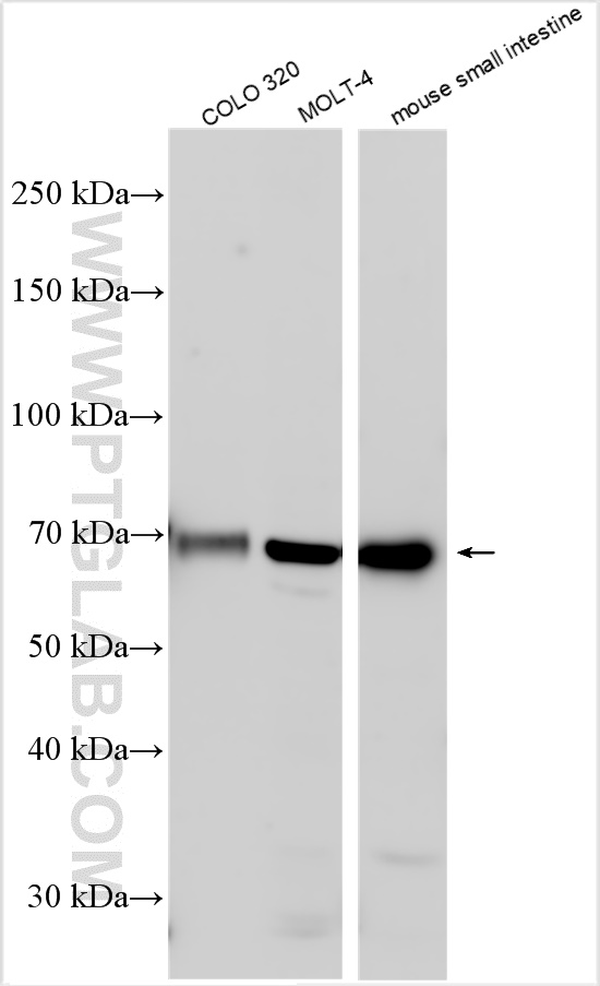 WB analysis using 21726-1-AP