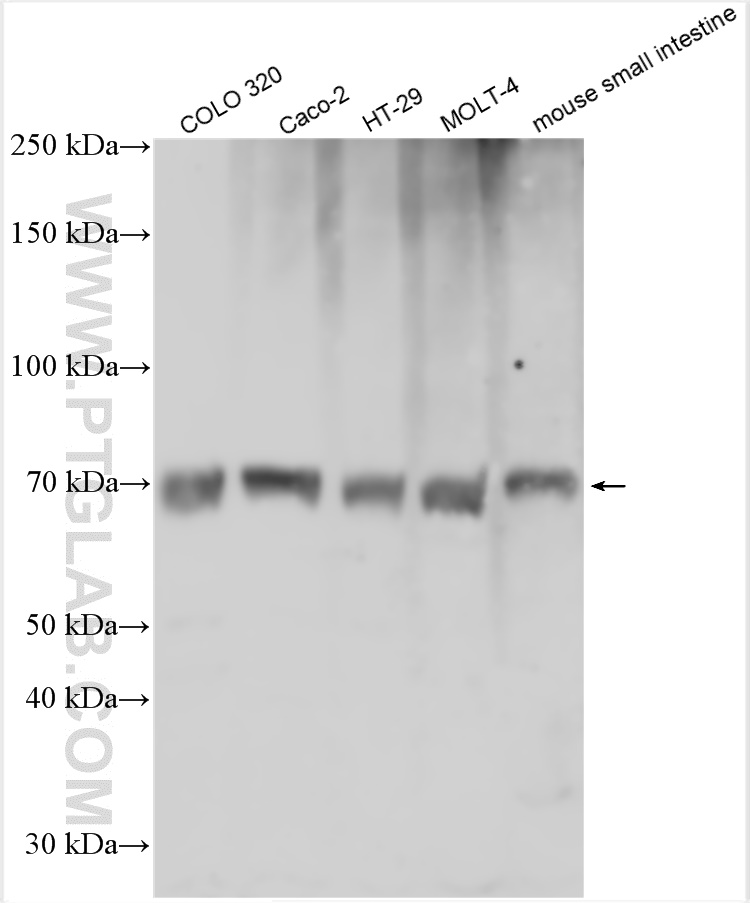 WB analysis using 21726-1-AP