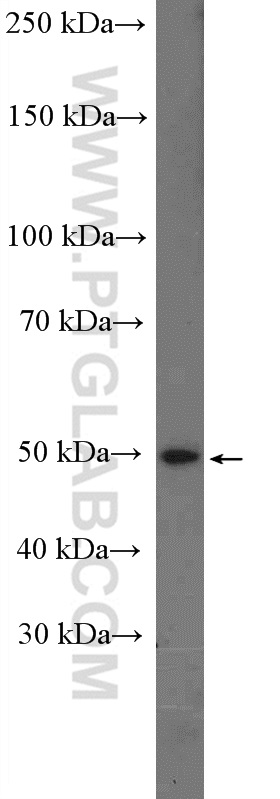 WB analysis of mouse kidney using 20676-1-AP