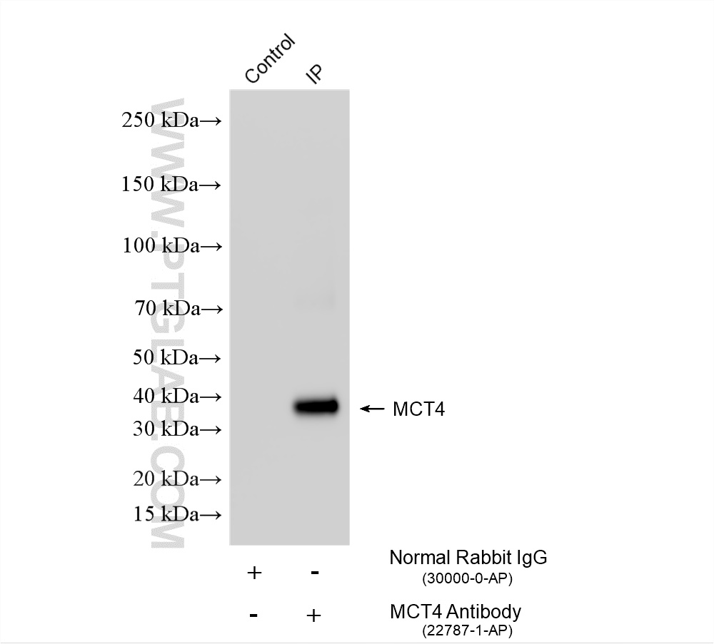 IP experiment of mouse skeletal muscle using 22787-1-AP IP experiment of mouse skeletal muscle using 22787-1-AP