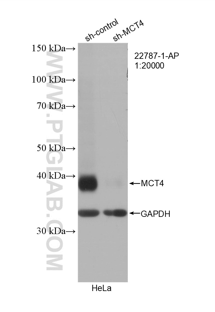 WB analysis of HeLa using 22787-1-AP WB analysis of HeLa using 22787-1-AP