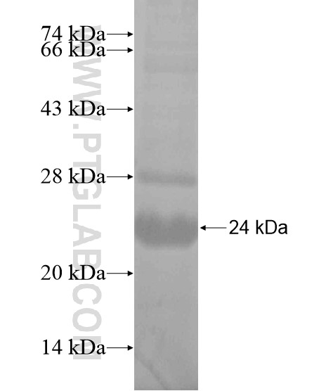 SLC16A3 fusion protein Ag19393 SDS-PAGE SLC16A3 fusion protein Ag19393 SDS-PAGE