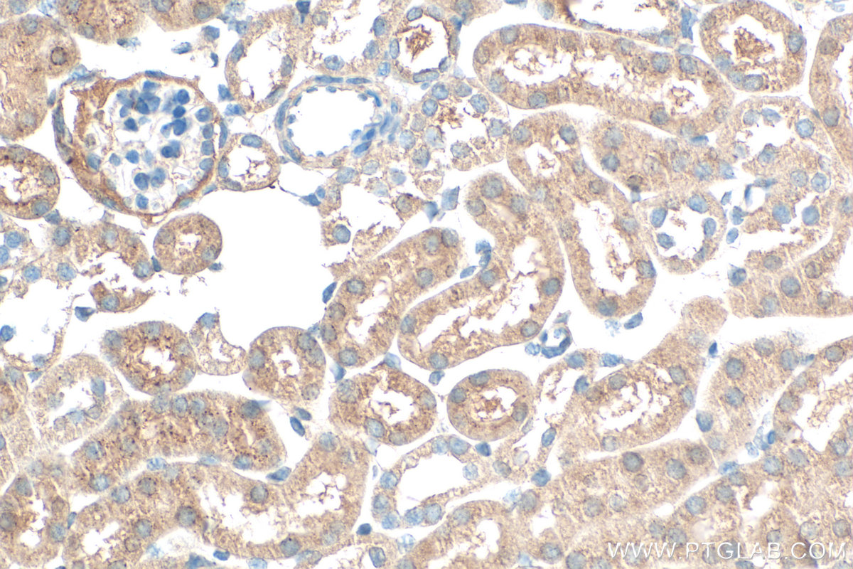Immunohistochemical analysis of paraffin-embedded mouse kidney tissue slide using 20889-1-AP (SLC16A4 antibody) at dilution of 1:200 (under 40x lens). Heat mediated antigen retrieval with Tris-EDTA buffer (pH 9.0). IHC staining of mouse kidney using 20889-1-AP