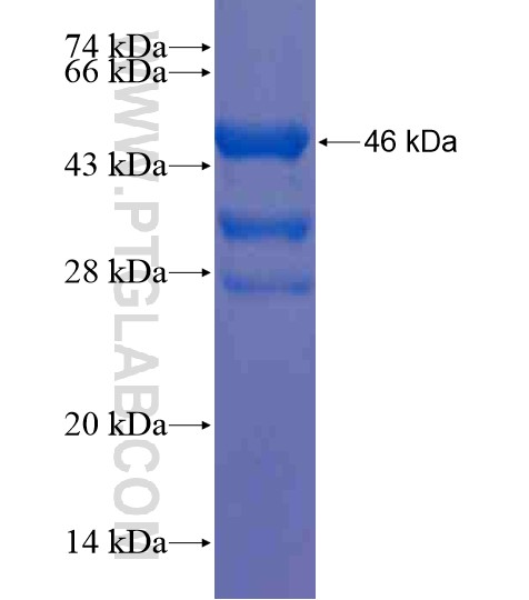 SLC16A8 fusion protein Ag20432 SDS-PAGE SLC16A8 fusion protein Ag20432 SDS-PAGE