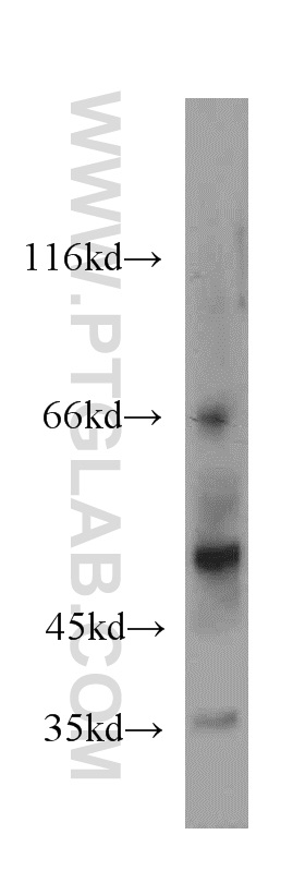 WB analysis of human placenta using 20751-1-AP