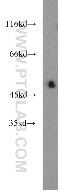 WB analysis of mouse kidney using 20751-1-AP