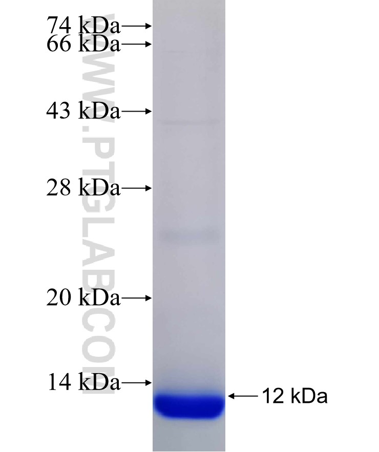 SLC17A3 fusion protein Ag30965 SDS-PAGE SLC17A3 fusion protein Ag30965 SDS-PAGE