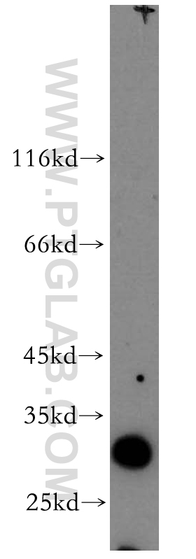 WB analysis of human kidney using 13320-1-AP