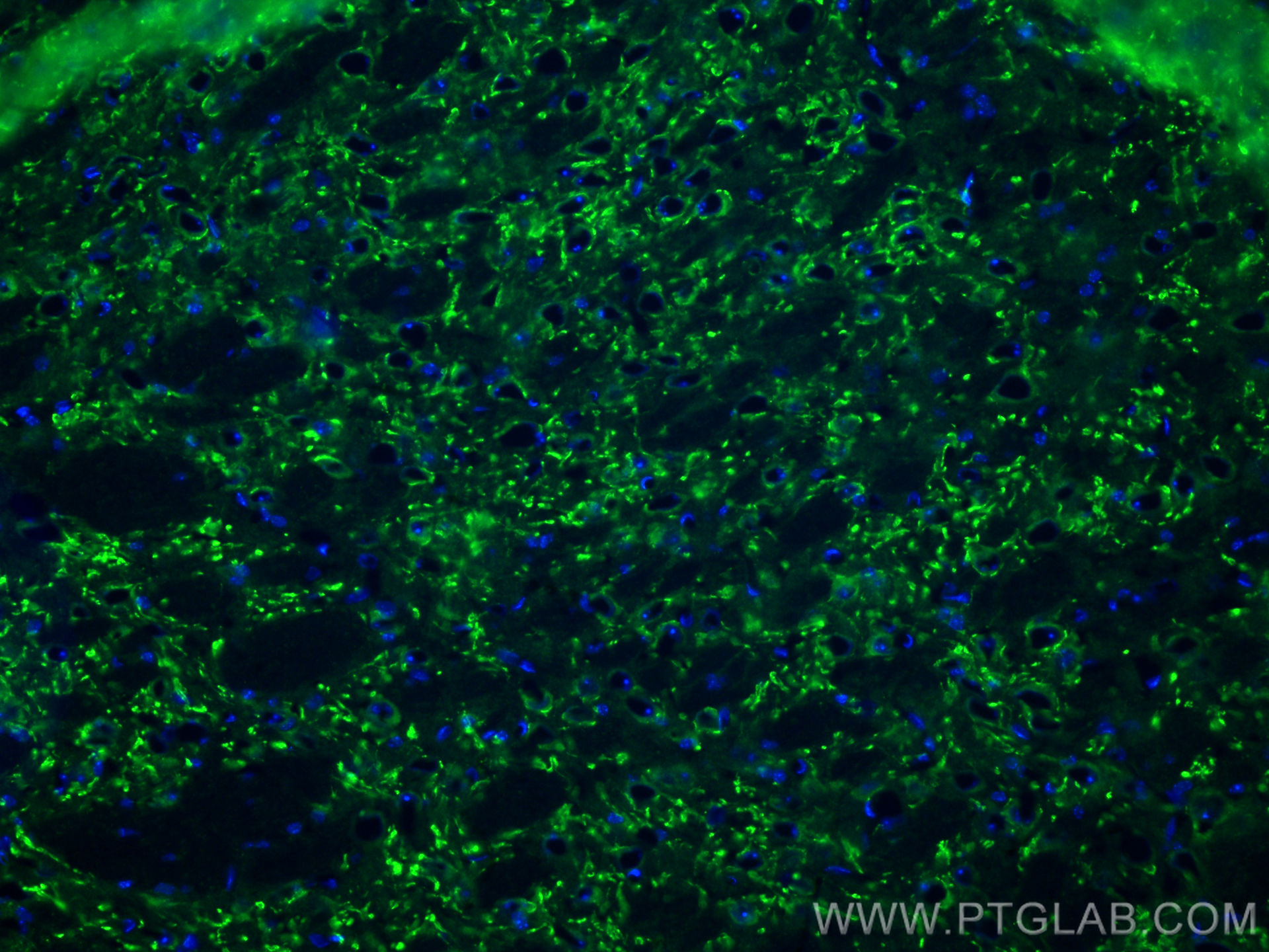 IF Staining of mouse brain using 84083-2-RR